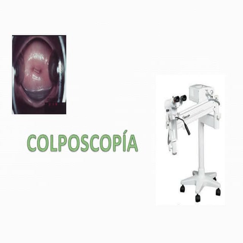 COLPO NM.pptx