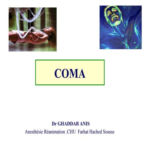Coma | PPTX