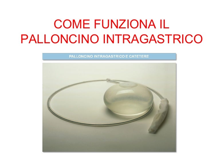 Come funziona il palloncino intragastrico