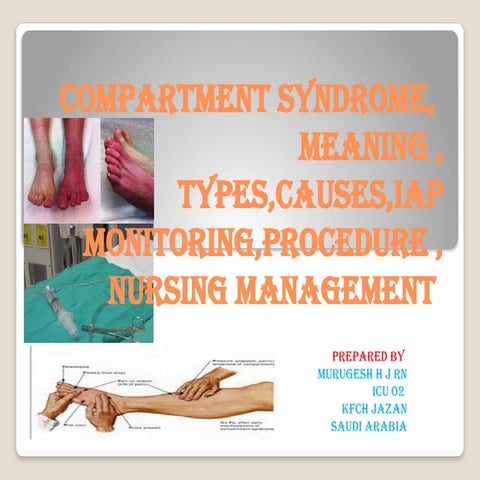 Compartment syndrome, meaning , types, causes , nursing management , murugesh.pptx