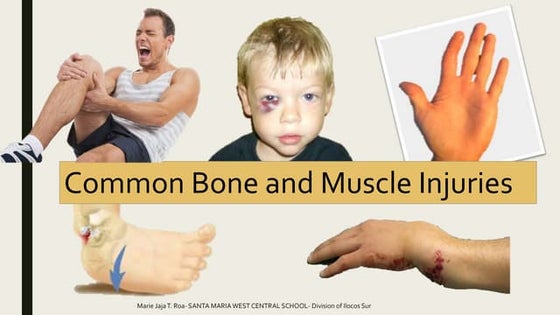 FIRST AID MEASURES IN POISONING | PPT