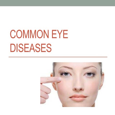 Common eye diseases