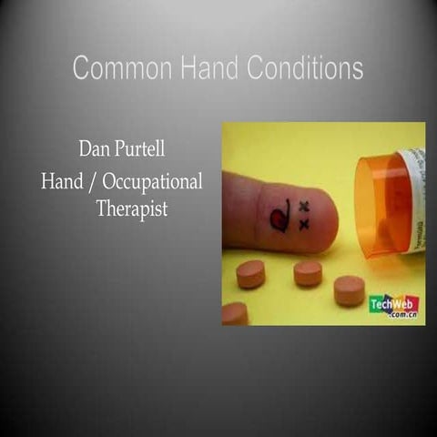 Common hand injuries