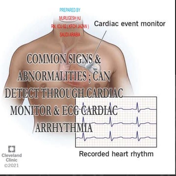 COMMON SIGNS & ABNORMALITIES _CAN DETECT IN CARDIAC MONITOR.pptx