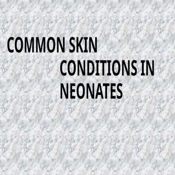 Common Skin Disorders in childrenpresentation