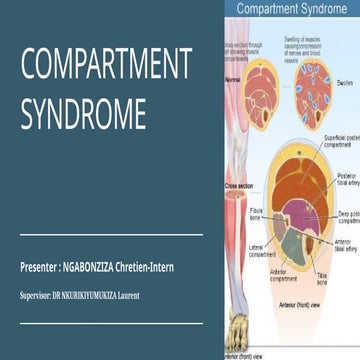 Compartment syndrome | PPTX