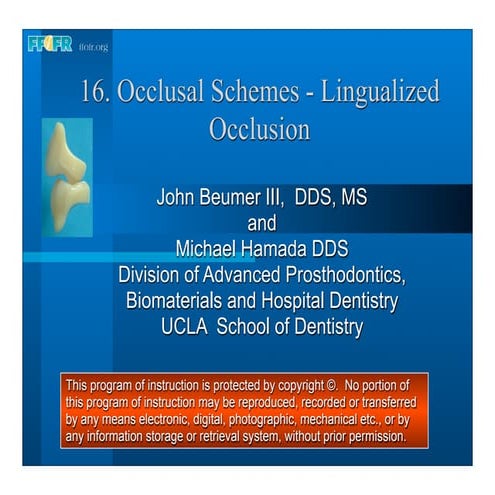 Complete dentures 16.occlusal schemes   lingualized occlusion