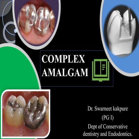 Complex amalgam restorations