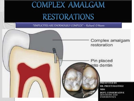 Endodontic Access Opening and Canal Location | PDF