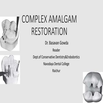 complex amalgam restoration.pptx