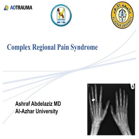 Complex regional pain syndrome 