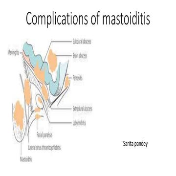 Complications of mastoiditis