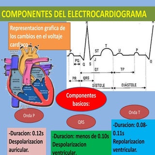 Componentes del electrocardiograma