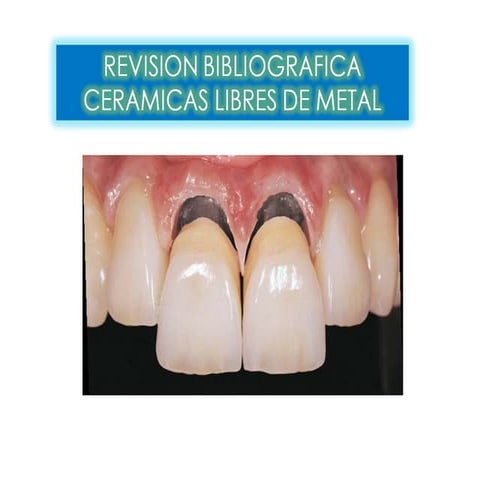 Comportamiento Biomecanico De Los Sistemas Ceramicos