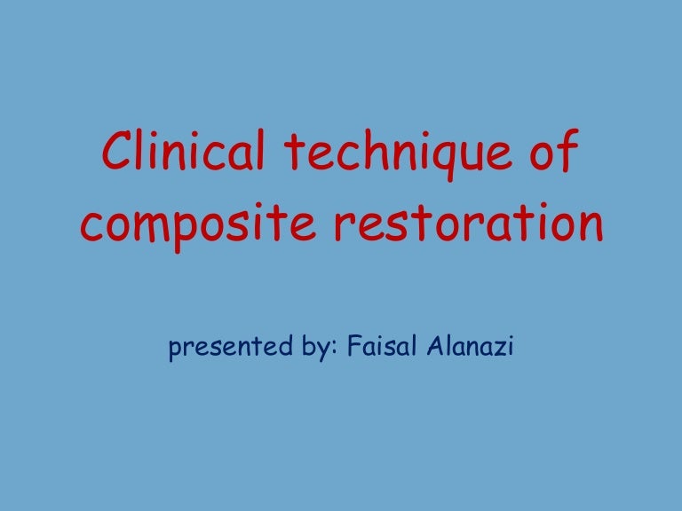 compositepreparation 101213135334 phpapp01 thumbnail 4 jpg cb 1292248507 prep technique