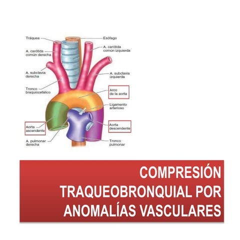MALFORMACIONES ANATOMICAS DEL ESOFAGO