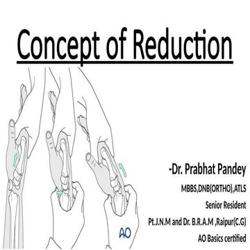 Concept of Fracture Reduction in orthopedics | PPTX