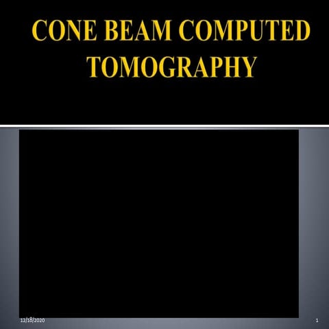 Cone beam ct