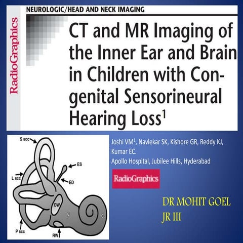 Congenital Sensoryneural hearing loss imaging