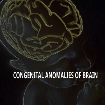Congenital anomalies of brain radiology 2.pptx