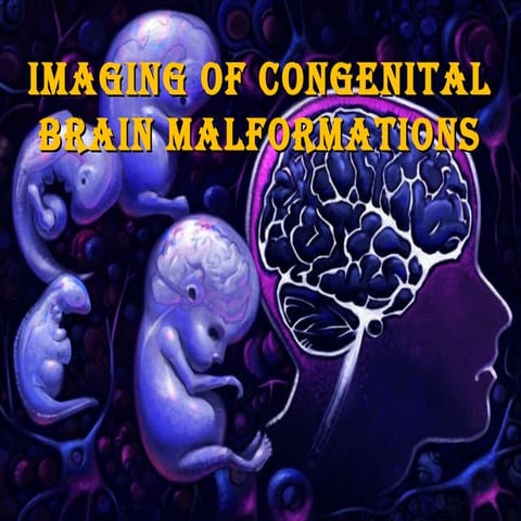 Congenitalbrainmalformations 150913122145-lva1-app6891