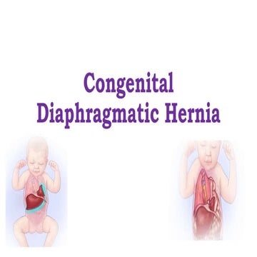 Congenital Diaphragmatic Hernia in newborn