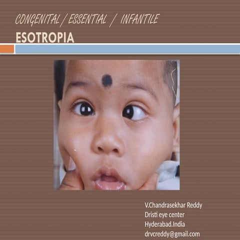 Congenital Esotropia diagnosis and management.pptx