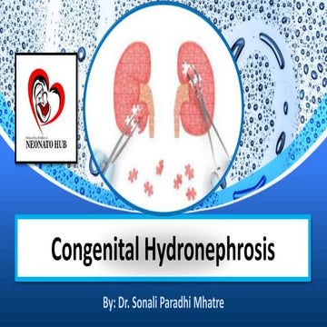 Antenatal Hydronephrosis