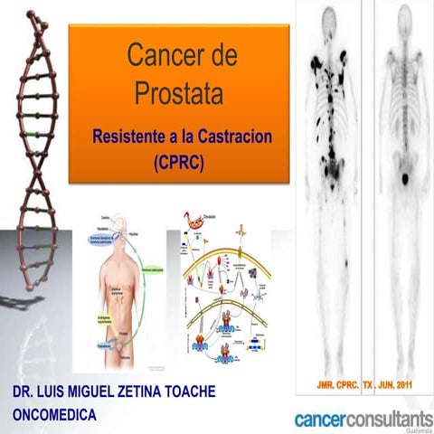 Prostate Cancer . Castration resistance