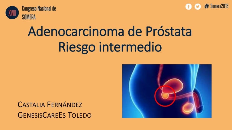 tratamiento para el cáncer de próstata desfavorable intermedio