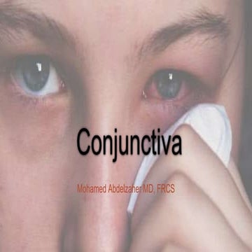 Conjunctiva
