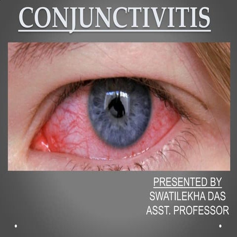 Conjunctivitis for Nurses- Easy Explanation