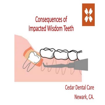 Consequences of impacted wisdom teeth 