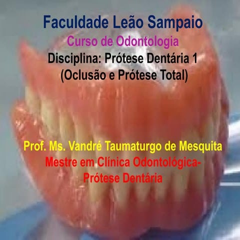 Considerações gerais sobre Prótese Total