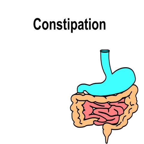 constipationscm-130526051303-phpapp01 (1).pptx