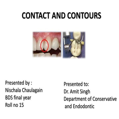 Contact and contours