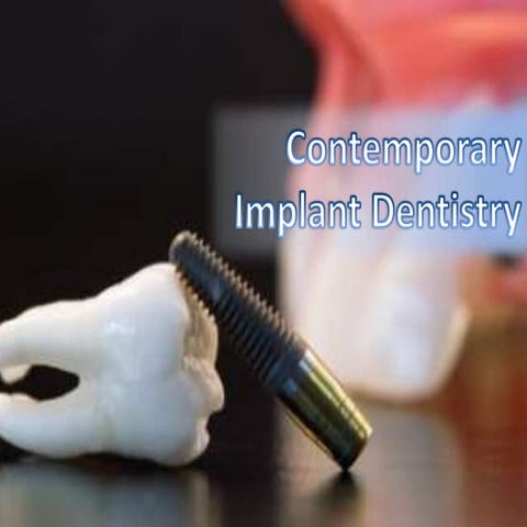 Contemporary implant dentistry