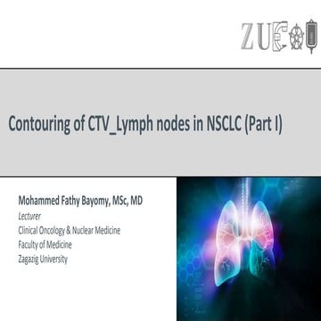 Contouring of CTV lymph nodes in NSCLC (Part I)