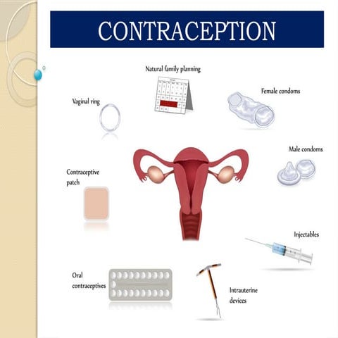 CONTRACEPTIVE METHODS | PPT