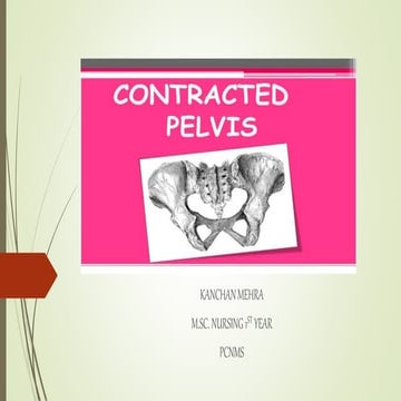 Contracted pelvis