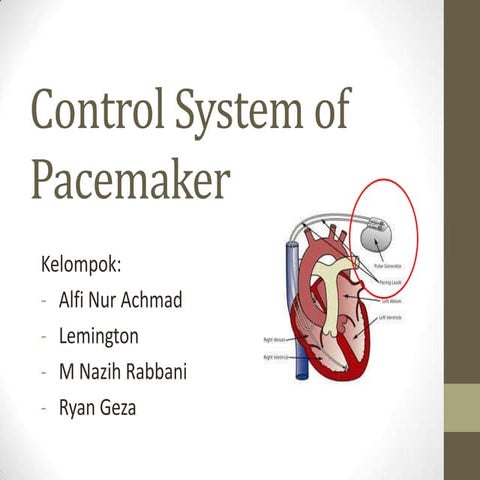 Control system of pacemaker