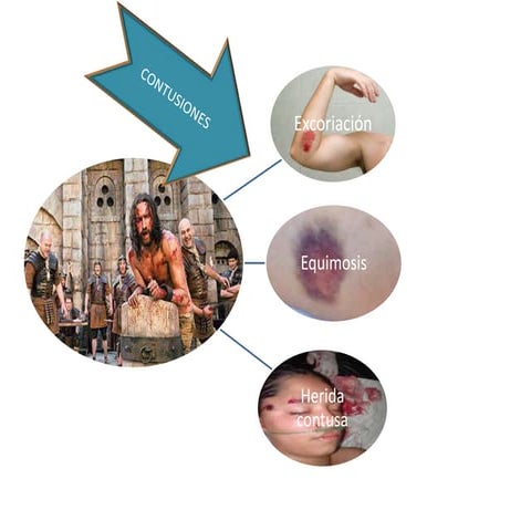 Contusiones 2