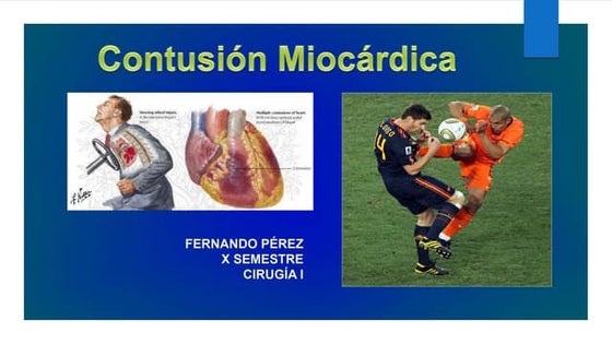 Contusion miocardica | PPTX | Death, Injury, or Military Conflict ...