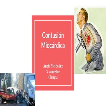 Contusion miocardica | PPTX