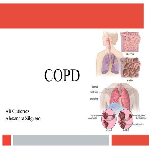 Copd 2