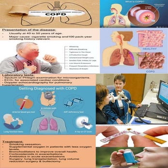 Chronic Obstructive Pulmonary Disease.pptx