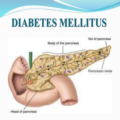 diabetes mellitus presentation