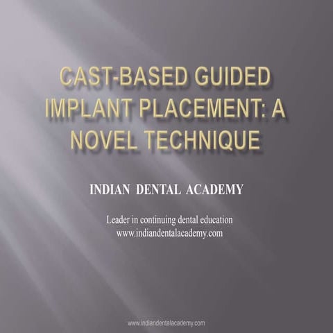 cast based guided implant placement/ general dentistry