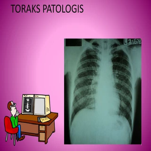 Bagaimana cara membaca foto rontgen/x-ray | PPT