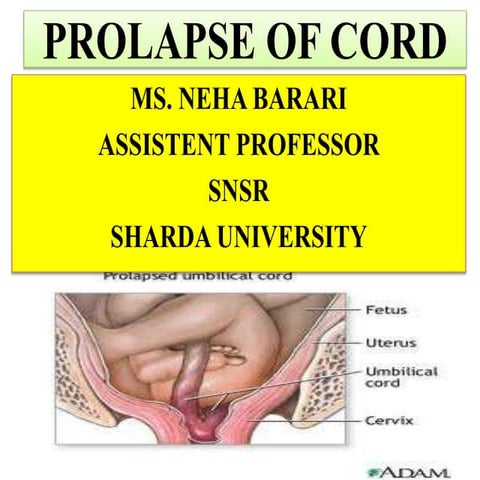 Cord prolapse
